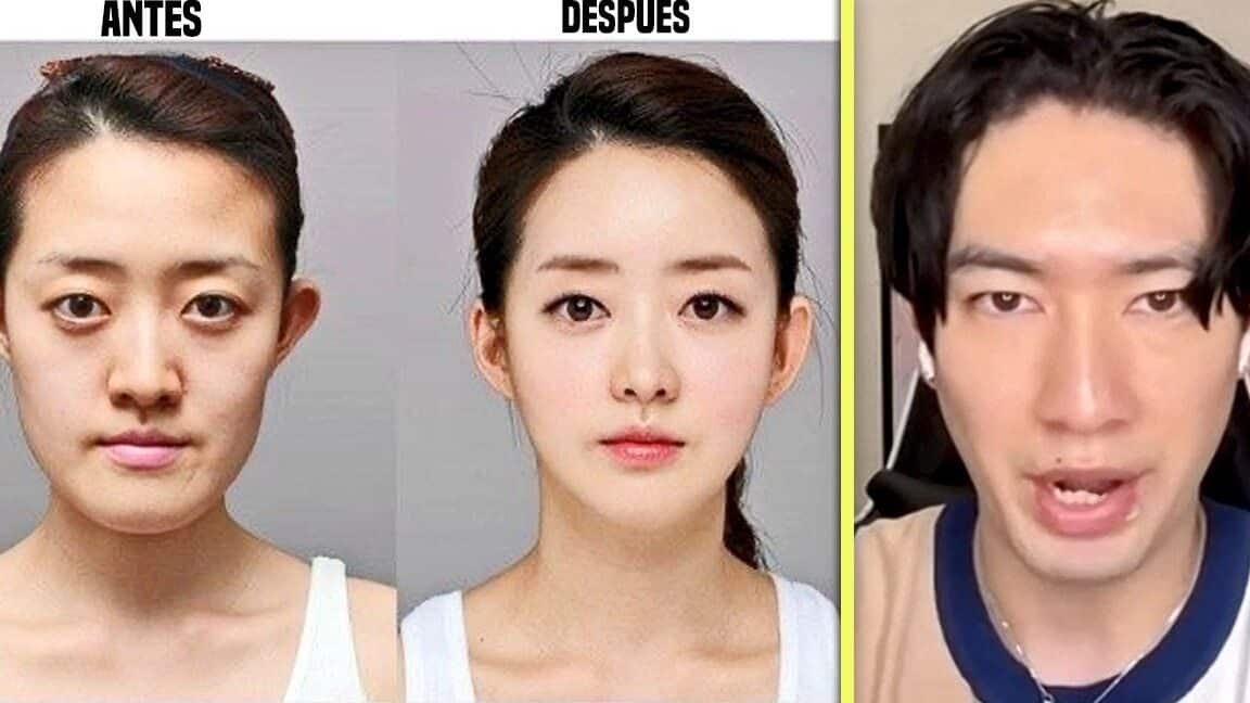 cirugia-plastica-en-corea-mitos-y-realidades
