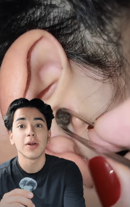 parte 2 del pelo de gato de los oidos